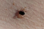 Doğu Karadeniz’de kene sezonu sakin geçiyor