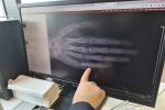 Eskişehir’de her ay 5 ila 7 çocuğa kanser tanısı konuluyor 