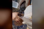 Kazada yaralanan kadının parmağına sıkışan yüzüğü itfaiye ekipleri çıkardı