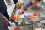 Kız çocuğu elini salça makinesine kaptırdı