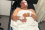 Motosiklet kazasında yaralandı, kardeşinin çarptığını iddia etti