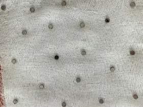 Çocuğun boğazından 19 adet mıknatıs çıkartıldı
