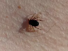 Doğu Karadeniz’de kene sezonu sakin geçiyor
