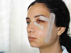 Eski eşini dövüp serbest kalan şüpheli tutuklandı
