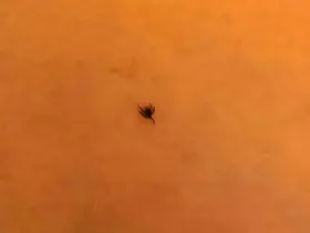 İnegöl’de kene alarmı
