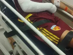 Kayserispor U19’da Hilmi Türkan’dan kötü haber
