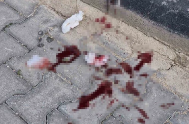 16 yaşındaki çocuk caddede bacağından bıçaklandı 