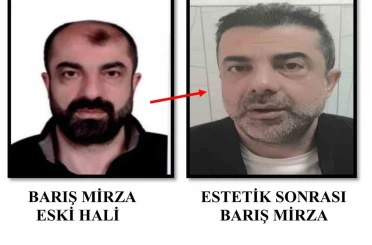 Ameliyat ile yüzünü değiştiren firari cinayet zanlısı, 7 yıl sonra yakalandı 