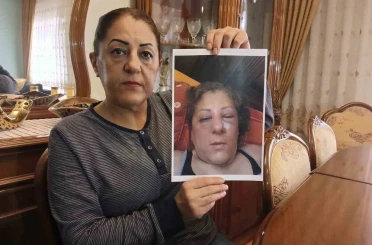 Apartman bahçesinde beslediği kediler nedeniyle komşuları tarafından darbedilen kadının burnu kırıldı 