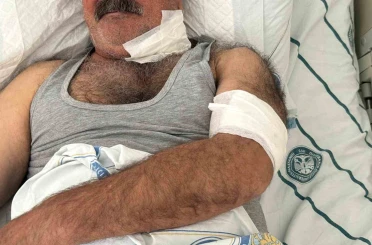 At sahibini boğazından ısırarak ağır yaraladı 