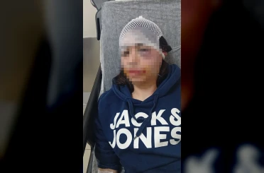 Ayrılık kararını kabullenemeyip kız arkadaşını darp etmişti: "Pişmanım" 