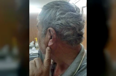 Doktor ile emekli öğretmenin mesai kavgası karakolda bitti 