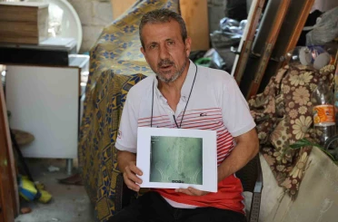 İş kazası geçirdi, ameliyat oldu, belinde panç unutuldu 