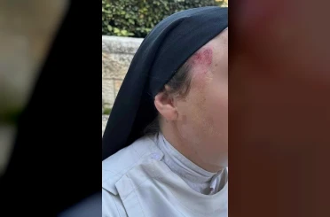 İsrail’de rahibeyi darbeden saldırgan gözaltına alındı 