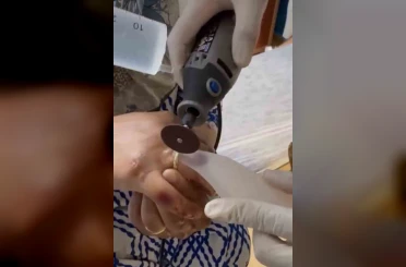 Kazada yaralanan kadının parmağına sıkışan yüzüğü itfaiye ekipleri çıkardı 