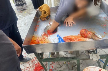 Kız çocuğu elini salça makinesine kaptırdı 