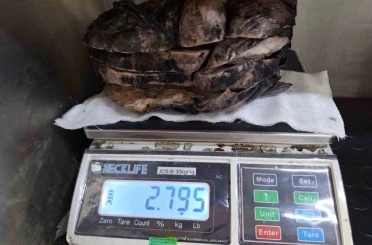 Nefes darlığı şikayeti ile hastaneye gitti, göğsünden 3 kilogramlık tümör çıktı 