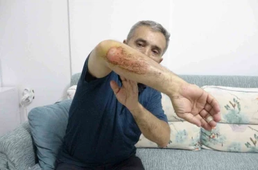 Otizmli oğluyla doğa gezisi sırasında sahipli köpeklerin saldırısına uğradı 