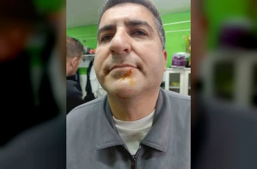 Zonguldak’ta 3. Lig maçı sonrası gerginlik: 2 gazeteci darbedildi, 2 polis yaralandı 