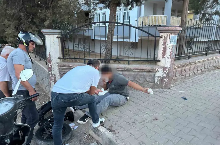Elektrikli bisiklet duvara çarptı: 1 yaralı
