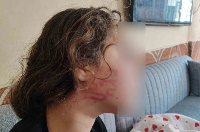 8 yaşındaki kızını darp eden çocuğun epilepsi hastası ablasını sokak ortasında dövdüğü iddiası