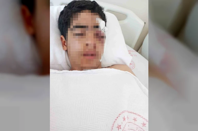Akran zorbalığına bir yenisi eklendi: 15 yaşındaki çocuk muştayla öldüresiye dövüldü