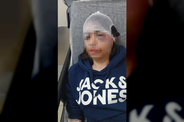 Ayrılık kararını kabullenemeyip kız arkadaşını darp etmişti: "Pişmanım"