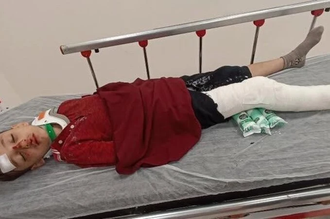 Başakşehir’de 8 yaşındaki çocuğa trafiğe kapalı alanda motosiklet çarptı: Baba yardım istedi