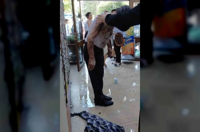 Bursa’da lavaboyu açmak için dökülen kimyasal madde patladı: 2 yaralı