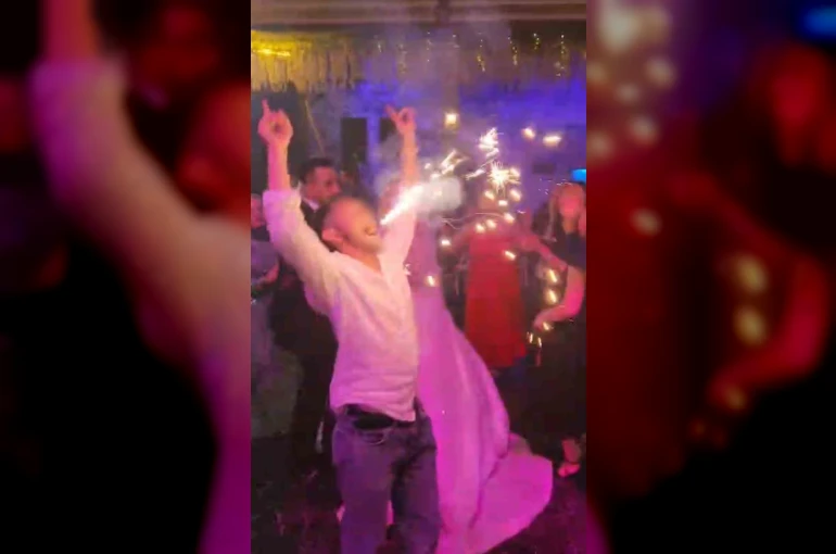 Düğünde ağzıyla tuttuğu meşale yüzünde patladı