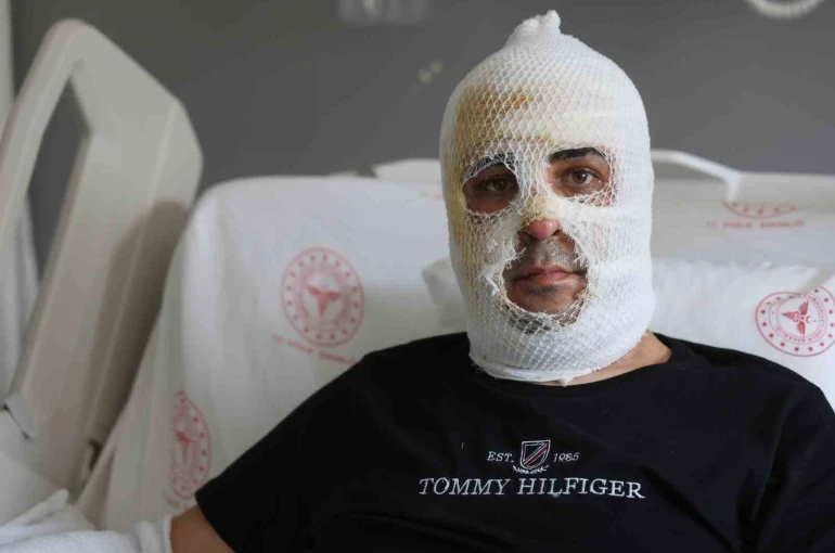 Ekmek teknesi küle dönmesin diye mücadele eden esnafın yüzü ve vücudu yaşanan patlamayla yandı