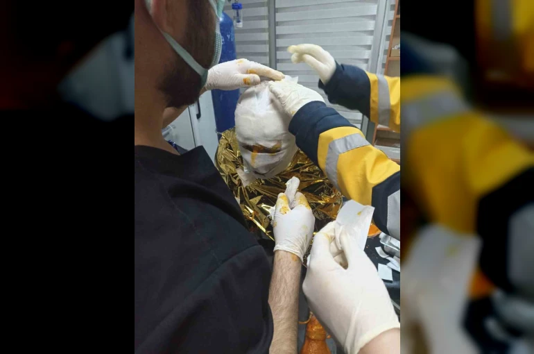 Erzincan’da kömür ocağında yangın: 2 işçi yaralı