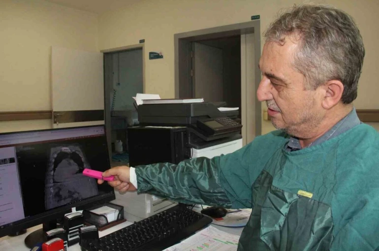 Giresun’dan tıp literatürüne yeni bir yaklaşım: "Karadeniz PEG Kuralı"