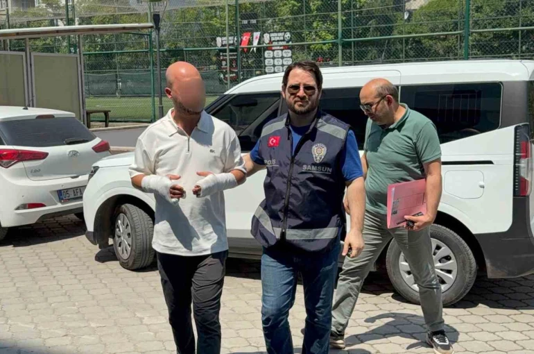 Güzellik merkezinde eski eşini hastanelik eden berbere gözaltı