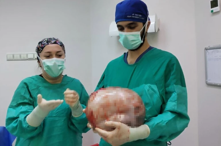 Karnı 2 ayda 9 aylık hamile gibi büyüyen kadının içinden karpuz kadar kitle çıkarıldı