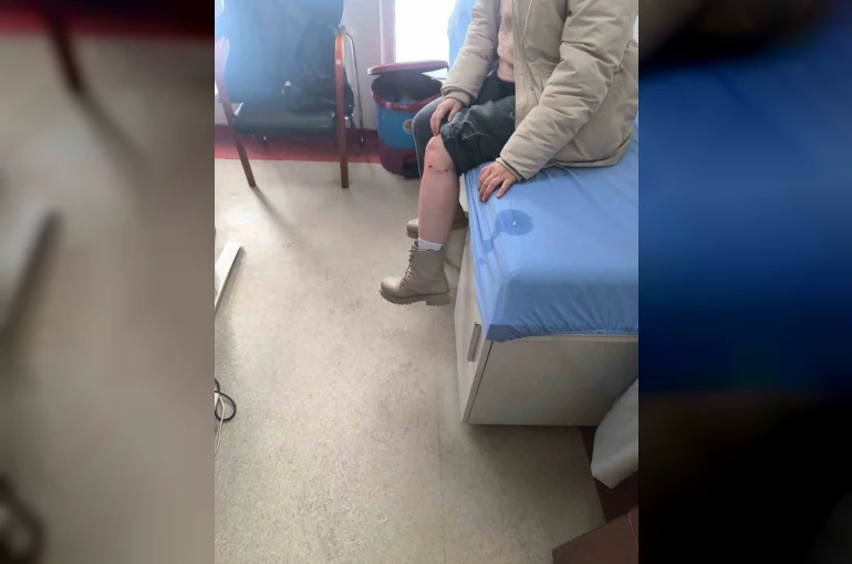Kayseri’de sokak köpeğinin saldırısına uğrayan çocuk yaralandı 
