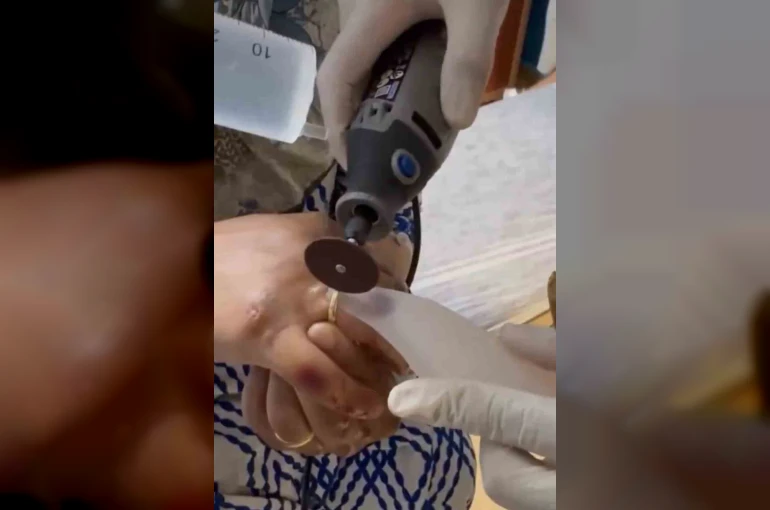 Kazada yaralanan kadının parmağına sıkışan yüzüğü itfaiye ekipleri çıkardı