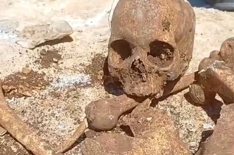 Malatya’da temel kazısında insan kemikleri bulundu