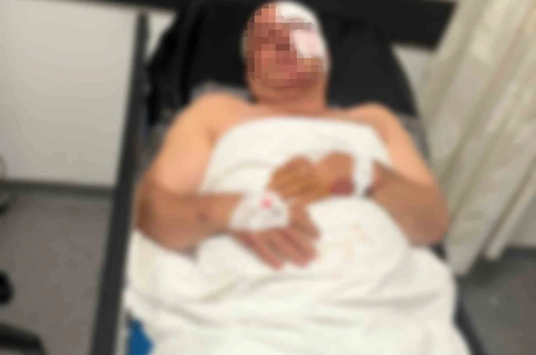 Motosiklet kazasında yaralandı, kardeşinin çarptığını iddia etti
