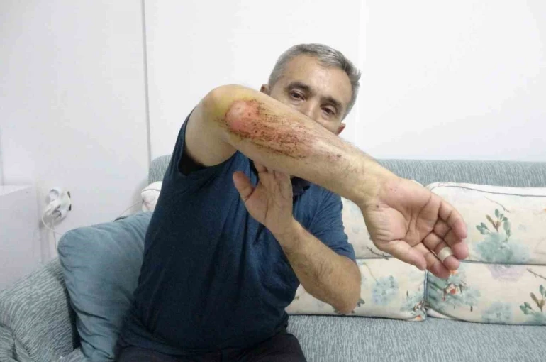 Otizmli oğluyla doğa gezisi sırasında sahipli köpeklerin saldırısına uğradı