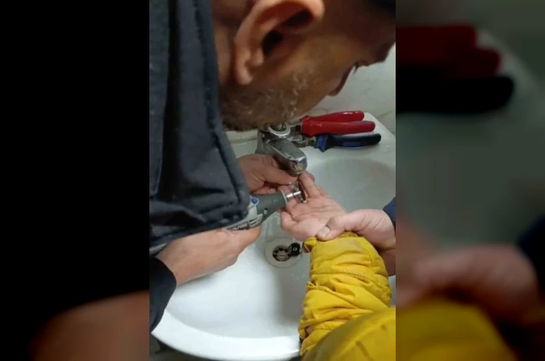 Parmağını metal paraya sıkıştırdı, itfaiye ekiplerince kurtarıldı