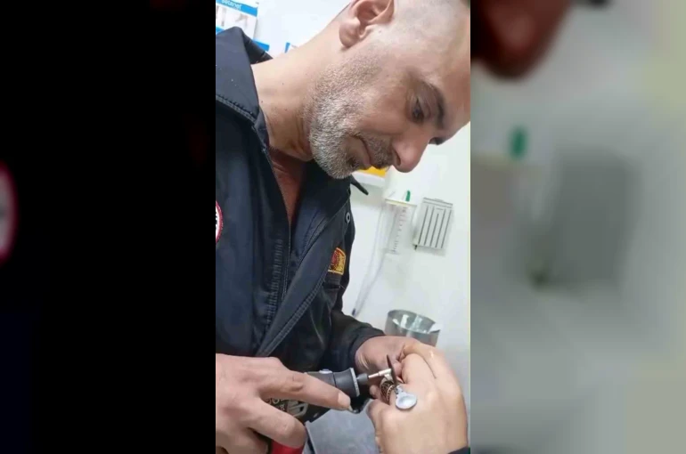 Sıkışan yüzük itfaiye ekiplerince çıkarıldı