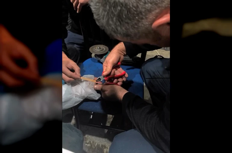 Vatandaşın parmağına yüzük sıkışan yüzüğü itfaiye çıkardı