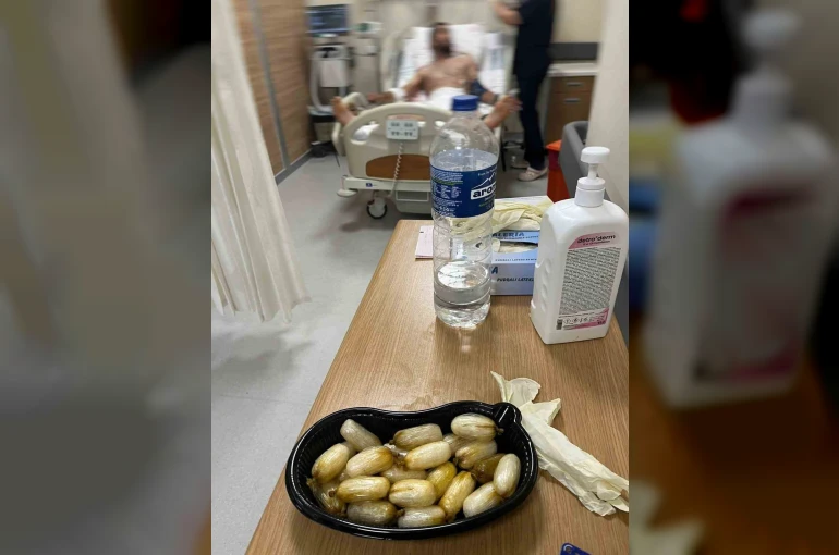 Vücudundan 5 günde 62 parça uyuşturucu çıktı