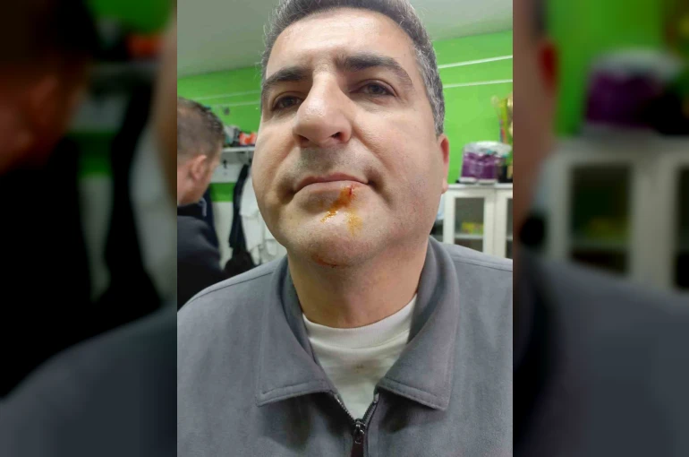 Zonguldak’ta 3. Lig maçı sonrası gerginlik: 2 gazeteci darbedildi, 2 polis yaralandı
